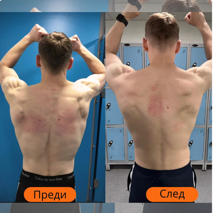 FlexiBack- Иновационен коректор за стойка, който премахва болките в гърба и връща правилната стойка